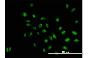 Immunofluorescence of purified MaxPab antibody to D21S2056E on HeLa cell. (RRP1 antibody  (AA 1-461))