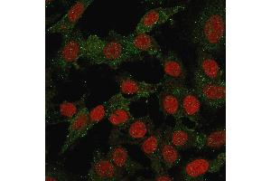 Immunofluorescence (IF) image for anti-V-Set Domain Containing T Cell Activation Inhibitor 1 (VTCN1) antibody (ABIN6940937)