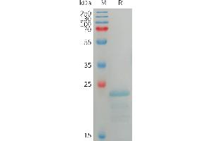 Human Protein, His Tag on SDS-PAGE under reducing condition. (SPA17 Protein (AA 1-151) (His tag))