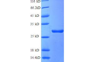 SDS-PAGE (SDS) image for Adrenergic, Beta, Receptor Kinase 1 (ADRBK1) (AA 2-634), (partial) protein (His tag) (ABIN5712097) (GRK2 Protein (AA 2-634, partial) (His tag))