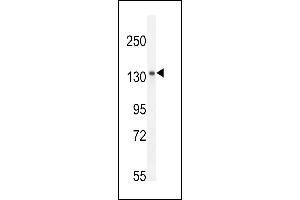Antibody (C-term) (ABIN654917 and ABIN2844562) western blot analysis in mouse spleen tissue lysates (35 μg/lane). (K1199 antibody  (C-Term))
