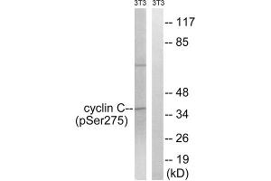 Western blot analysis of extracts from 3T3 cells, treated with UV (15mins), using Cyclin C (Phospho-Ser275) antibody. (Cyclin C antibody  (pSer275))