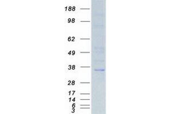 NKX3-1 Protein (Myc-DYKDDDDK Tag)