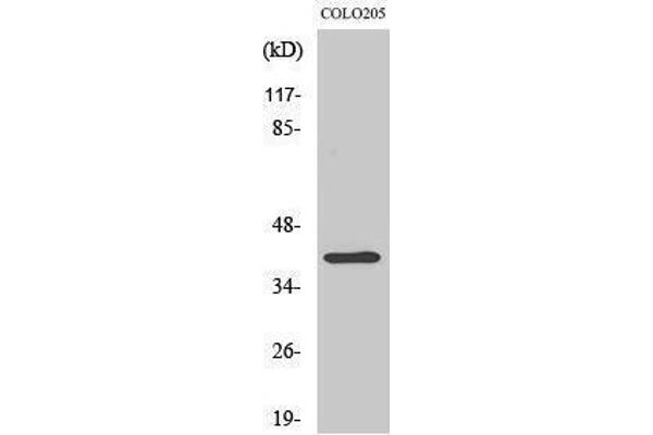 DOK6 antibody  (Internal Region)