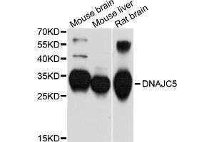 Western blot analysis of extracts of various cell lines, using DNAJC5 antibody. (DNAJC5 antibody)