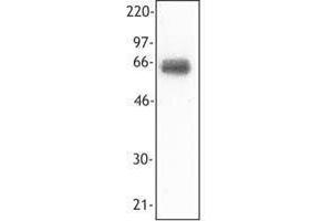 Western Blotting (WB) image for anti-Triggering Receptor Expressed On Myeloid Cells 1 (TREM1) antibody (ABIN2664607) (TREM1 antibody)