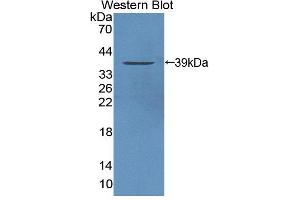 Western blot analysis of the recombinant protein. (PTPN9 antibody  (AA 289-593))