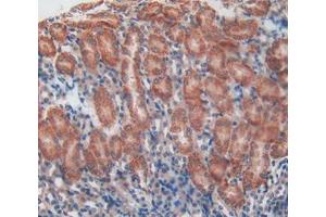Used in DAB staining on fromalin fixed paraffin- embedded kidney tissue (Talin antibody  (AA 975-1181))