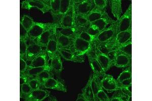 Immunofluorescent staining of HeLa cells. (beta-2 Microglobulin antibody)