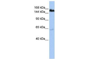 Western Blotting (WB) image for anti-Tankyrase, TRF1-Interacting Ankyrin-Related ADP-Ribose Polymerase (TNKS) antibody (ABIN2458044) (TNKS antibody)