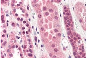 Human Kidney (formalin-fixed, paraffin-embedded) stained with STEAP1 antibody ABIN364397 at 10 ug/ml followed by biotinylated anti-mouse IgG secondary antibody ABIN481714, alkaline phosphatase-streptavidin and chromogen. (STEAP1 antibody  (AA 1-70))