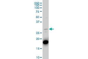 PNMT polyclonal antibody (A01), Lot # 051128JC01 Western Blot analysis of PNMT expression in IMR-32 . (PNMT antibody  (AA 1-110))