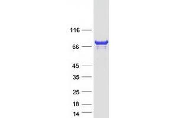 CENPB Protein (Myc-DYKDDDDK Tag)