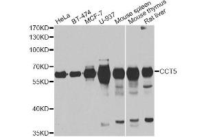 Western blot analysis of extracts of various cell lines, using CCT5 antibody. (CCT5 antibody)