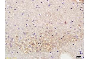 Formalin-fixed and paraffin embedded mouse kidney labeled with Anti RASSF3 Polyclonal Antibody, Unconjugated (ABIN762101) at 1:200 followed by conjugation to the secondary antibody and DAB staining (RASSF3 antibody  (AA 51-150))