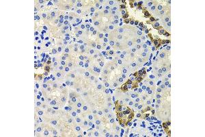 Immunohistochemistry of paraffin-embedded mouse kidney using CALB2 antibody at dilution of 1:100 (x40 lens). (Calretinin antibody)