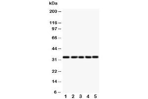 Western blot testing of E2F6 antibody and Lane 1:  HeLa (E2F6 antibody  (Middle Region))