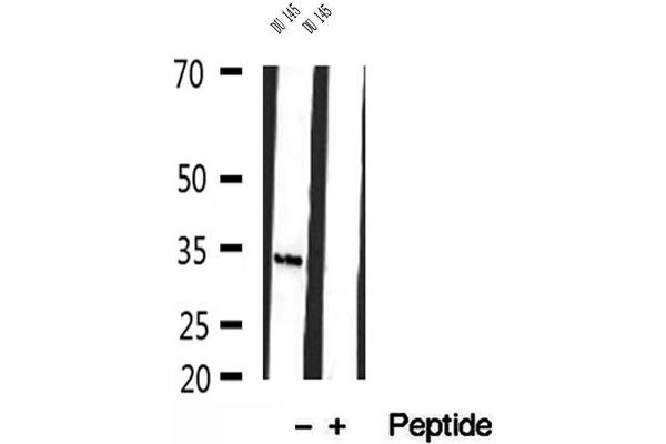 HEY1 antibody  (Internal Region)