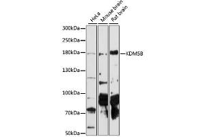 Western blot analysis of extracts of various cell lines, using KDM5B antibody (ABIN6293336) at 1:1000 dilution. (KDM5B antibody)