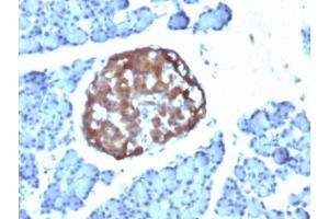 Immunohistochemistry (IHC) image for anti-Chromogranin A (CHGA) antibody (ABIN3024536)