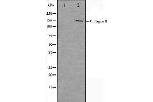 COL2A1 antibody  (N-Term)