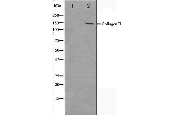 COL2A1 antibody  (N-Term)