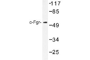 Image no. 1 for anti-Gardner-Rasheed Feline Sarcoma Viral (V-Fgr) Oncogene Homolog (FGR) antibody (ABIN272160) (Fgr antibody)
