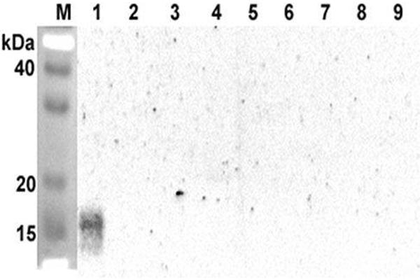 ANGPTL5 antibody  (Coiled coil domain)