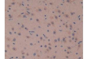 Detection of SOSTDC1 in Mouse Brain Tissue using Polyclonal Antibody to Sclerostin Domain Containing Protein 1 (SOSTDC1) (SOSTDC1 antibody  (AA 24-206))