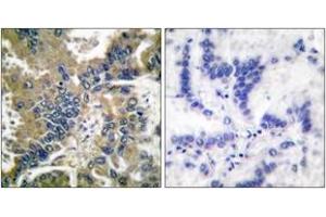 Immunohistochemistry (IHC) image for anti-Caspase 1 (CASP1) (AA 161-210), (Cleaved-Asp210) antibody (ABIN2891162) (Caspase 1 antibody  (Cleaved-Asp210))