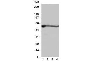 Western blot testing of ALDH2 antibody and rat samples; Lane 1: liver;  2: intestine;  3: lung;  4: kidney tissue lysate (ALDH2 antibody  (N-Term))