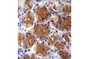 Formalin fixed and paraffin embedded human stomach tissue reacted FAM108C1 Antibody (Center) followed by peroxidase conjugation of the secondary antibody and DAB staining. (ABHD17C antibody  (Middle Region))