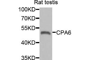 Western blot analysis of extracts of rat testis, using CPA6 antibody (ABIN5975028) at 1/1000 dilution. (CPA6 antibody)