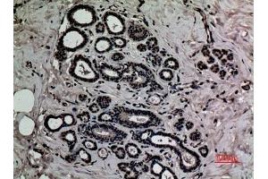 Immunohistochemical analysis of paraffin-embedded human-breast, antibody was diluted at 1:100. (HMGB1 antibody  (acLys12))