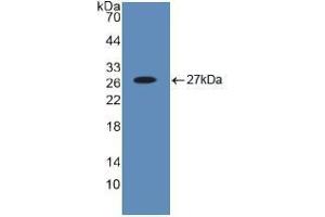 Western blot analysis of recombinant Human Bid. (BID antibody  (AA 1-195))