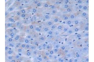 IHC-P analysis of Rat Liver Tissue, with DAB staining. (alpha 2 Antiplasmin antibody  (AA 348-491))