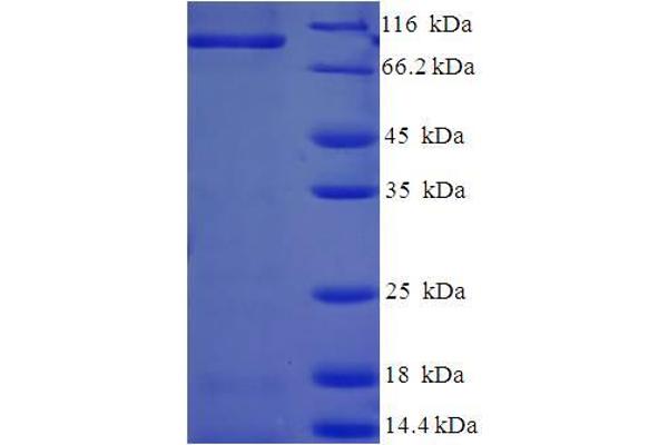 Caprin-1 Protein (AA 2-707) (His-SUMO Tag)