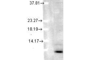 Image no. 1 for anti-Ubiquitin (Ubiquitin) antibody (ABIN1502294) (Ubiquitin antibody)