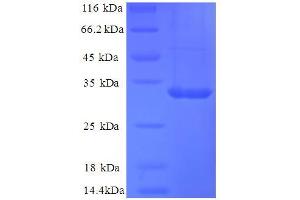 SDS-PAGE (SDS) image for Carbonic Anhydrase 12 (CA12) (AA 25-301), (Extracellular) protein (His tag) (ABIN5713304) (CA12 Protein (AA 25-301, Extracellular) (His tag))