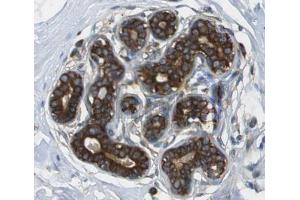 IHC analysis of colon tissue, using Cytokeratin 13 Antibody at 1:100. (Cytokeratin 13 antibody  (Internal Region))