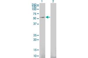 Western Blot analysis of GFRA1 expression in transfected 293T cell line by GFRA1 monoclonal antibody (M03), clone 3E4. (GFRA1 antibody  (AA 32-119))