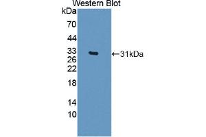 Figure. (CELSR3 antibody  (AA 1181-1421))