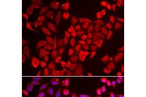 Immunofluorescence analysis of U2OS cells using TNP2 Polyclonal Antibody (TNP2 antibody)