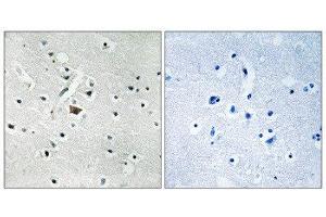 Immunohistochemistry (IHC) image for anti-Phospholipase D2 (PLD2) (pTyr169) antibody (ABIN1847811) (Phospholipase D2 antibody  (pTyr169))