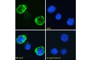 Immunofluorescence staining of fixed Jurkat cells with anti-CD7 antibody 3A1E. (Recombinant CD7 antibody)