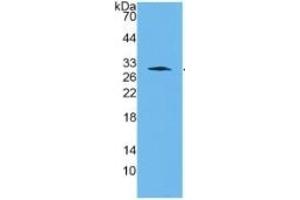 Western Blotting (WB) image for Cathepsin K (CTSK) ELISA Kit (ABIN6574151)