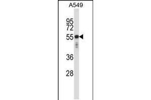 Western blot analysis in A549 cell line lysates (35ug/lane). (Keratin 6C antibody  (N-Term))
