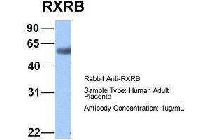 Host:  Rabbit  Target Name:  RXRB  Sample Type:  Human Adult Placenta  Antibody Dilution:  1. (Retinoid X Receptor beta antibody  (N-Term))