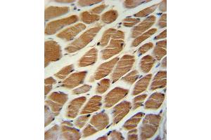 Immunohistochemistry (IHC) image for anti-Acyl-CoA Dehydrogenase, Long Chain (ACADL) antibody (ABIN3003793) (ACADL antibody)