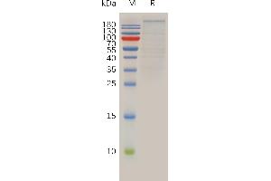 BRD4 Protein (AA 1-1362) (Fc Tag)